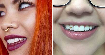 「歯の宝石」がファッション界で流行　医師は衛生面の注意を喚起